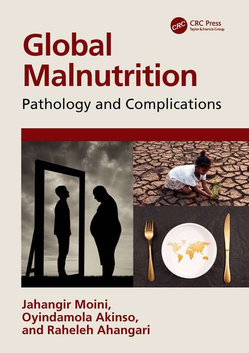 Book cover of Global Malnutrition: Pathology and Complications