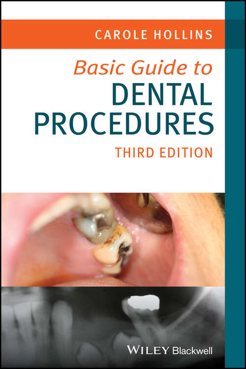 Book cover of Basic Guide to Dental Procedures (3) (Basic Guide Dentistry Series)