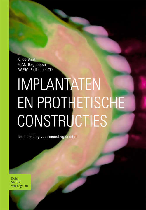 Book cover of Implantaten en prothetische constructies: Een inleiding voor mondhygiënisten (2003)