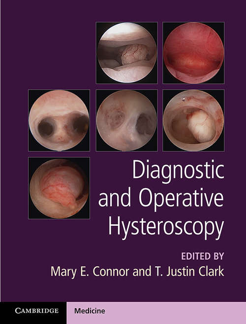 Diagnostic and Operative Hysteroscopy