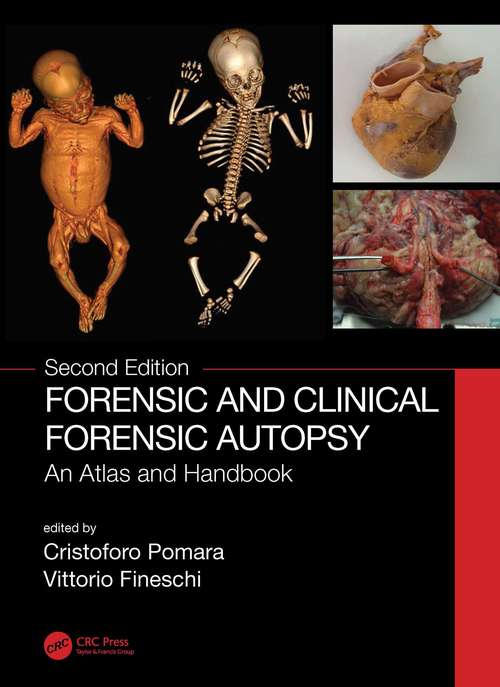 Book cover of Forensic and Clinical Forensic Autopsy: An Atlas and Handbook (2)