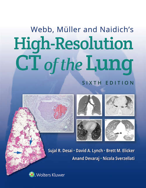 Webb, Müller and Naidich's High-Resolution CT of the Lung