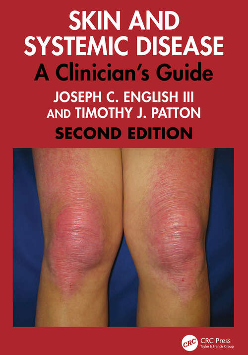 Book cover of Skin and Systemic Disease: A Clinician's Guide (2)
