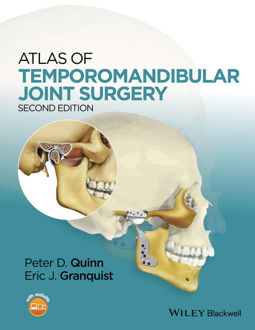 Book cover of Atlas of Temporomandibular Joint Surgery
