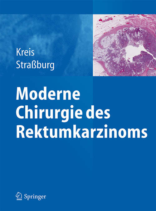 Book cover of Moderne Chirurgie des Rektumkarzinoms