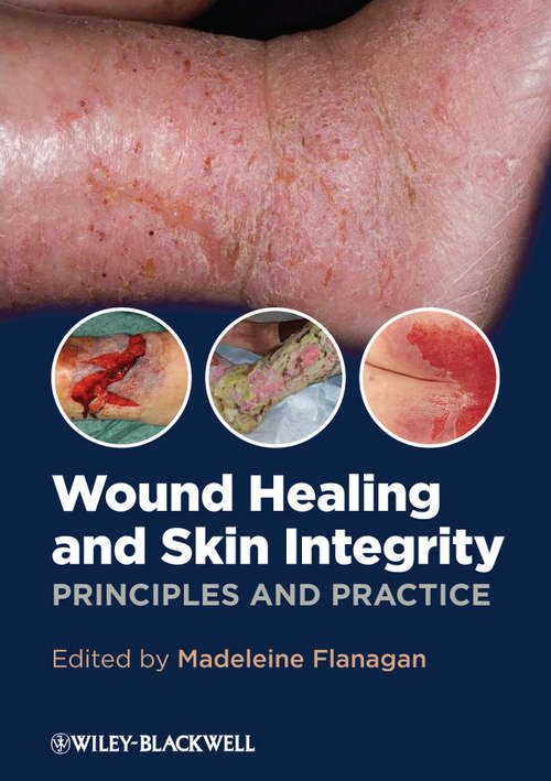 Book cover of Wound Healing and Skin Integrity