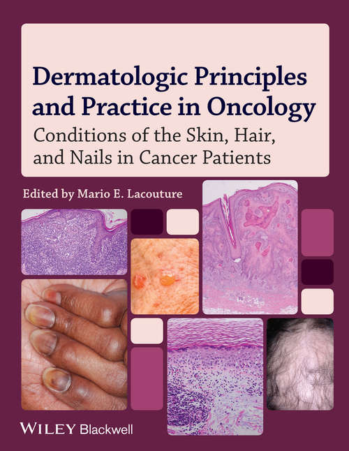 Book cover of Dermatologic Principles and Practice in Oncology