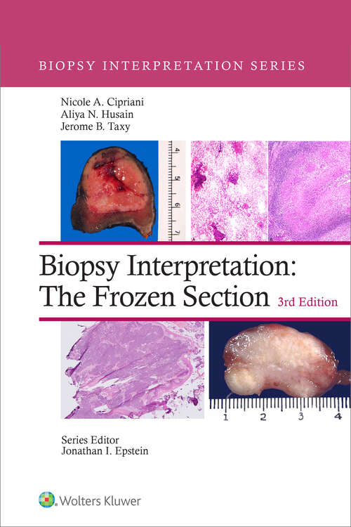 Book cover of Biopsy Interpretation: The Frozen Section (Biopsy Interpretation)