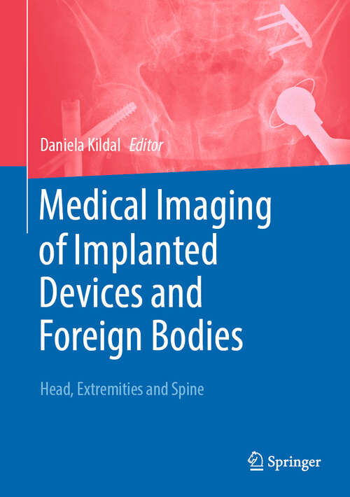 Book cover of Medical Imaging of Implanted Devices and Foreign Bodies: Head, Extremities and Spine