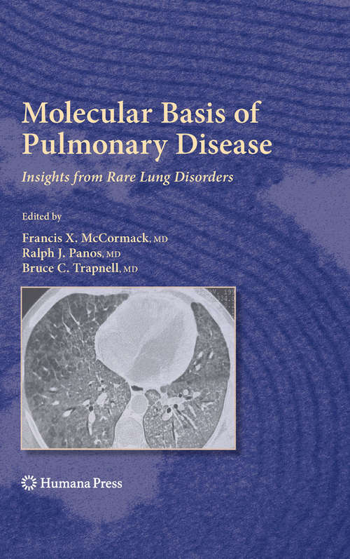 Book cover of Molecular Basis of Pulmonary Disease