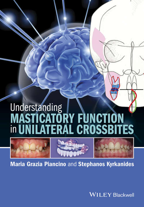 Book cover of Understanding Masticatory Function in Unilateral Crossbites