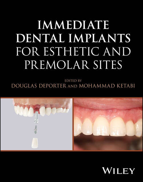 Book cover of Immediate Dental Implants for Esthetic and Premolar Sites