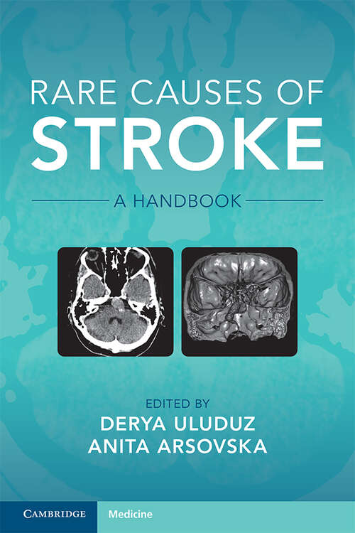 Book cover of Rare Causes of Stroke: A Handbook