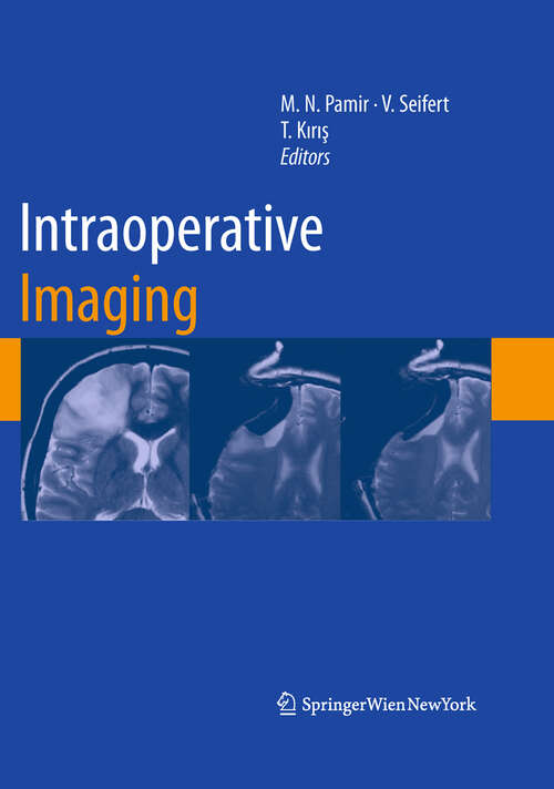 Book cover of Intraoperative Imaging