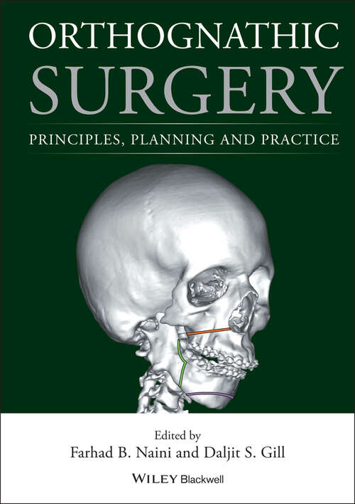 Orthognathic Surgery: Principles, Planning and Practice