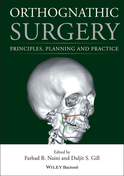 Book cover of Orthognathic Surgery: Principles, Planning and Practice