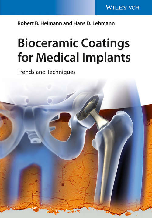 Book cover of Bioceramic Coatings for Medical Implants