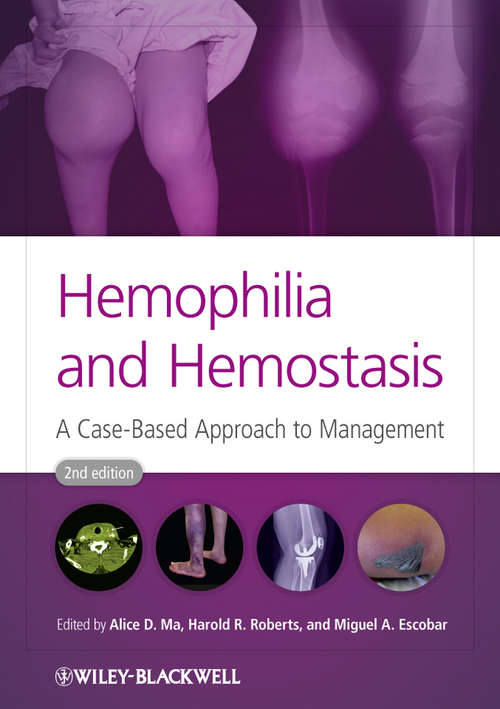 Hemophilia and Hemostasis
