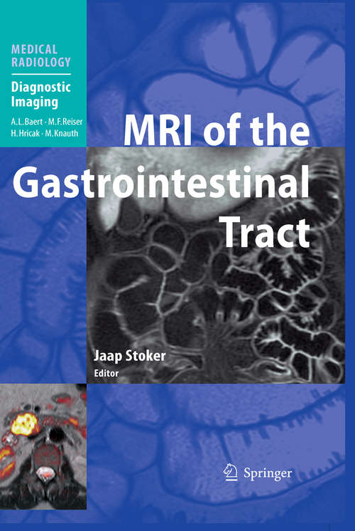 Book cover of MRI of the Gastrointestinal Tract