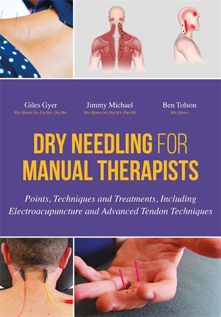 Book cover of Dry Needling for Manual Therapists: Points, Techniques and Treatments, Including Electroacupuncture and Advanced Tendon Techniques