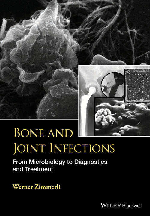 Book cover of Bone and Joint Infections