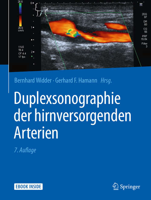 Book cover of Duplexsonographie der hirnversorgenden Arterien