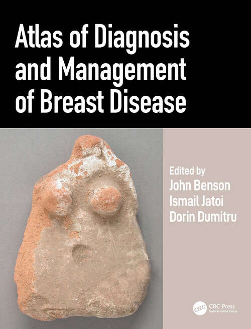 Book cover of Atlas of Diagnosis and Management of Breast Disease (1)