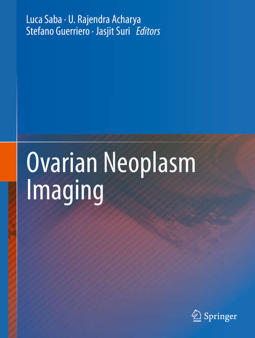 Ovarian Neoplasm Imaging