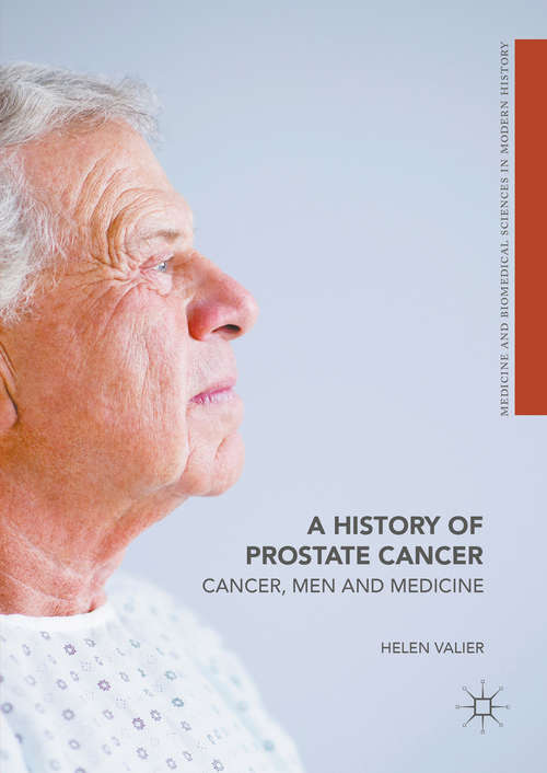 Book cover of A History of Prostate Cancer: Cancer, Men and Medicine (Medicine and Biomedical Sciences in Modern History)