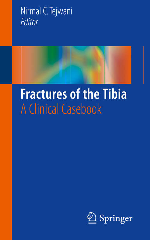 Book cover of Fractures of the Tibia