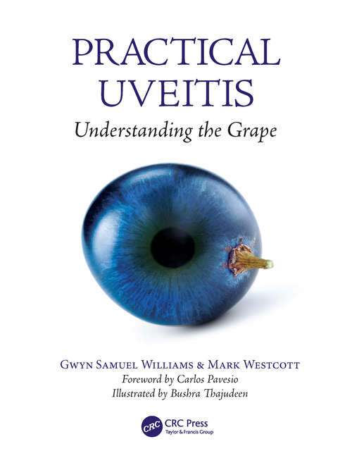 Practical Uveitis: Understanding the Grape