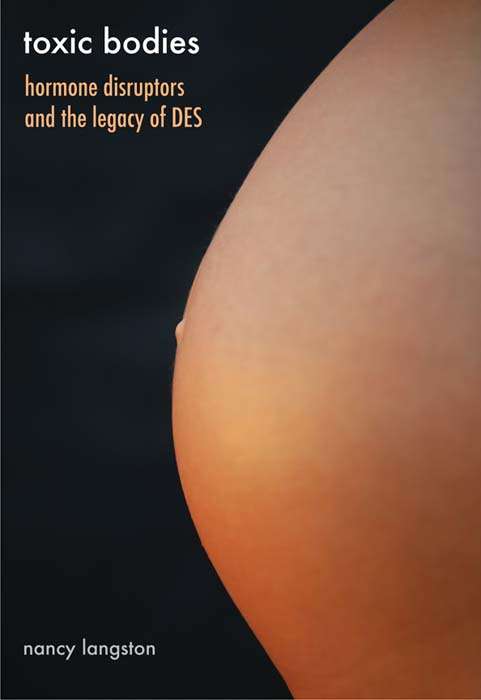 Book cover of Toxic Bodies: Hormone Disruptors and the Legacy of DES