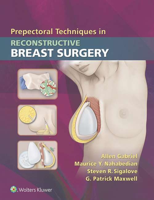 Prepectoral Techniques in Reconstructive Breast Surgery