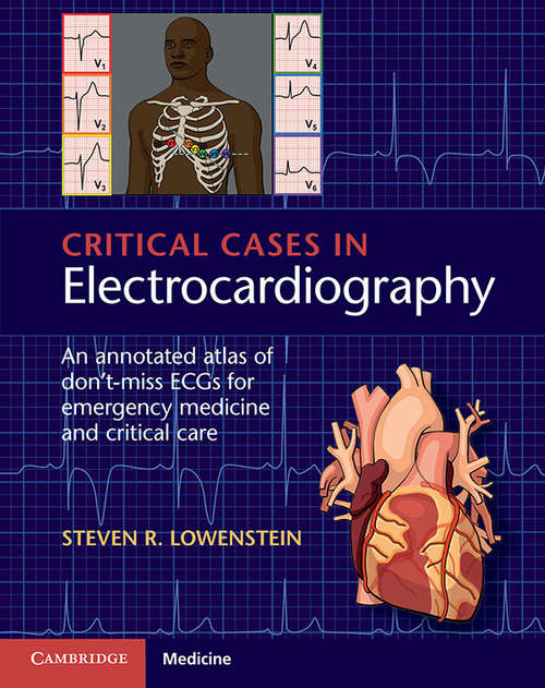 Book cover of Critical Cases in Electrocardiography: An Annotated Atlas Of Don't-miss Ecgs For Emergency And Critical Care