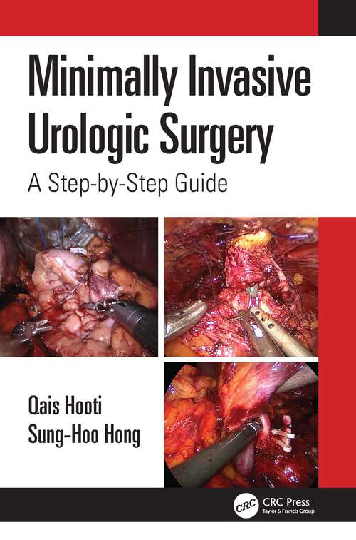 Minimally Invasive Urologic Surgery: A Step-by-Step Guide