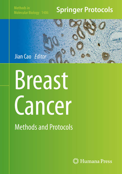 Breast Cancer: Methods and Protocols (Methods in Molecular Biology #1406)