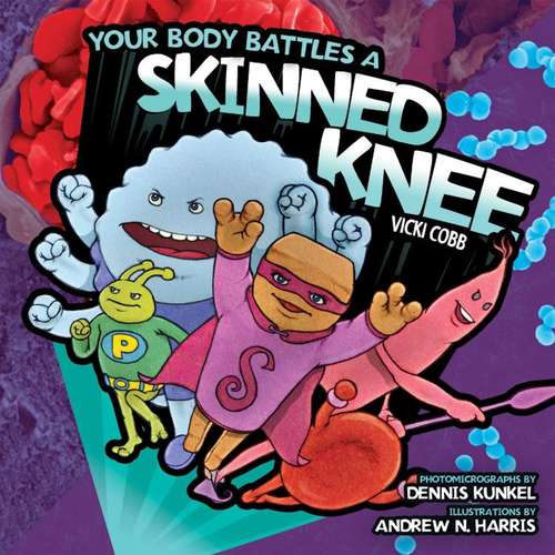 Book cover of Your Body Battles a Skinned Knee