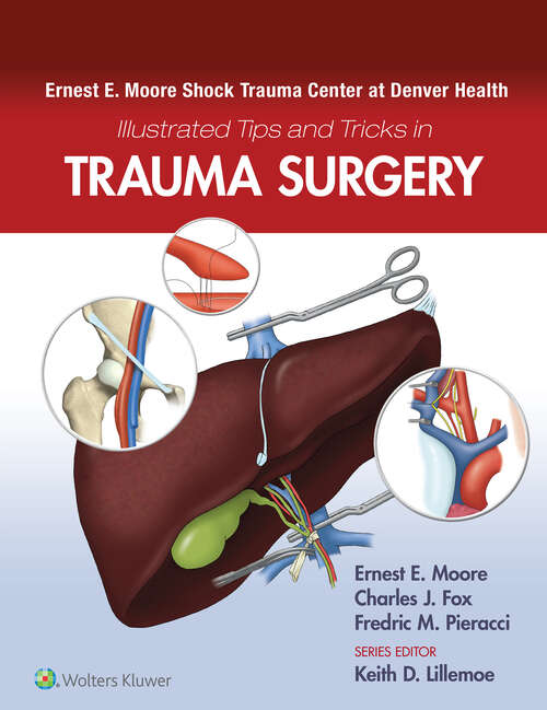 Book cover of Ernest E. Moore Shock Trauma Center at Denver Health Illustrated Tips and Tricks in Trauma Surgery