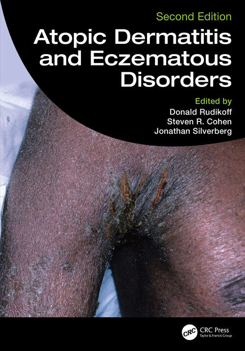 Book cover of Atopic Dermatitis and Eczematous Disorders (2)