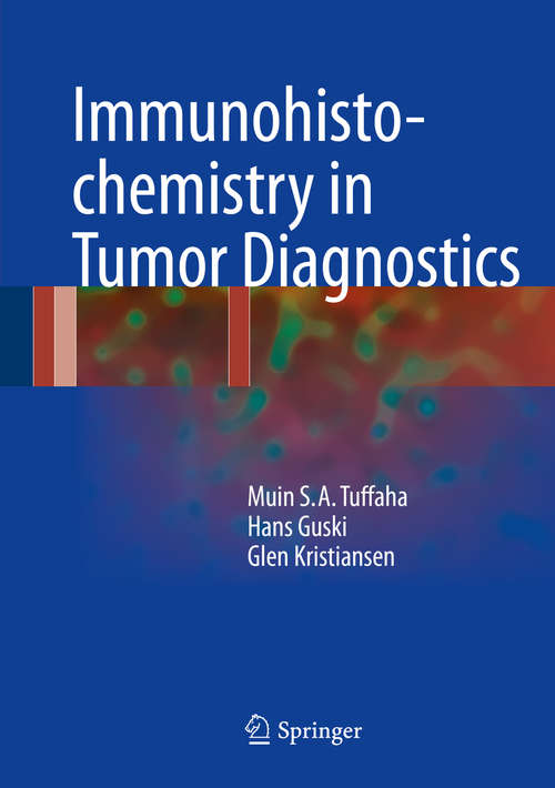 Immunohistochemistry in Tumor Diagnostics