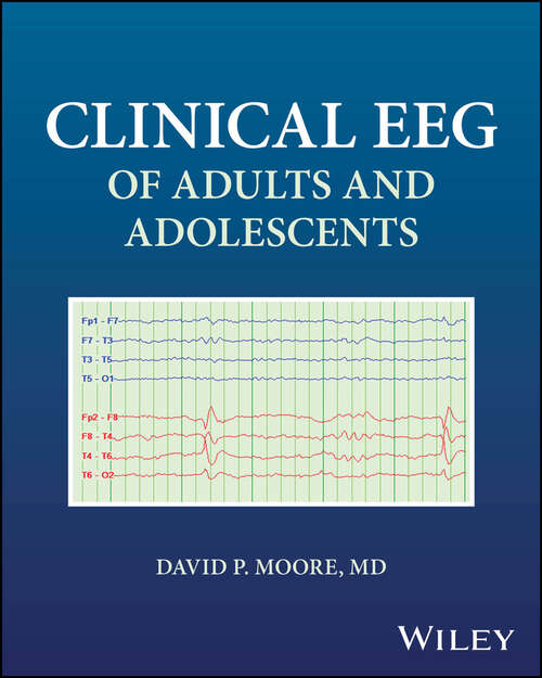 Book cover of Clinical EEG of Adults and Adolescents