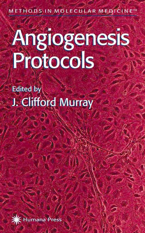 Book cover of Angiogenesis Protocols (Methods in Molecular Medicine #46)