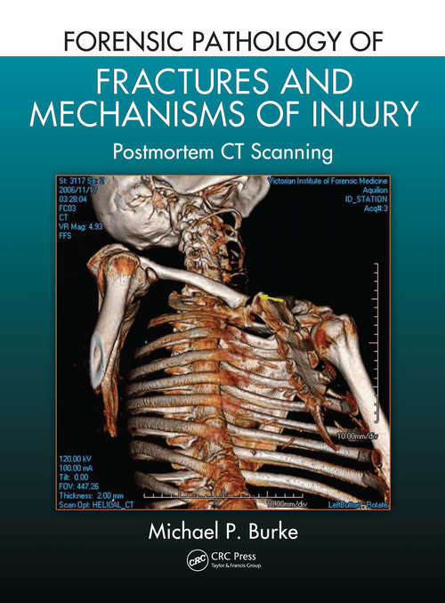 Book cover of Forensic Pathology of Fractures and Mechanisms of Injury: Postmortem CT Scanning