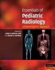 Book cover of Essentials of Pediatric Radiology