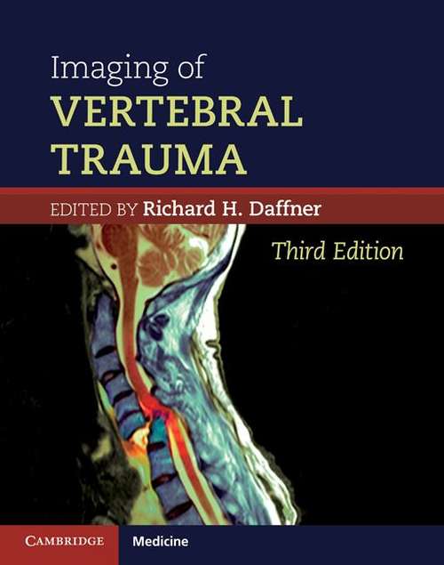 Book cover of Imaging of Vertebral Trauma
