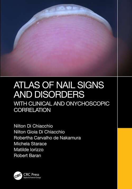 Book cover of Atlas of Nail Signs and Disorders with Clinical and Onychoscopic Correlation