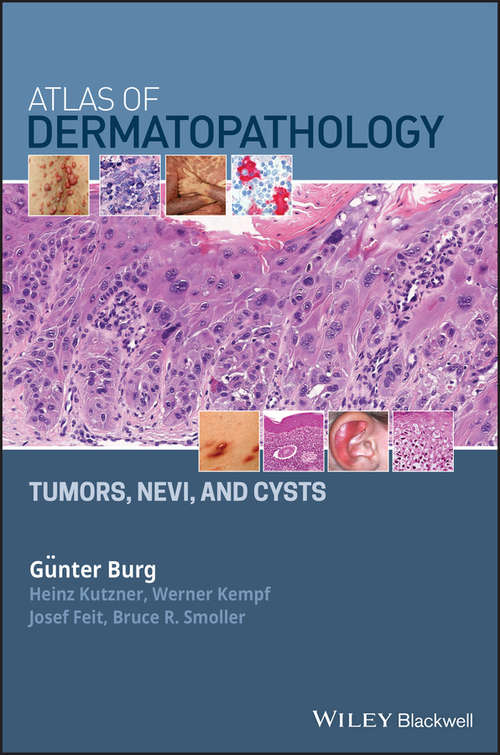 Atlas of Dermatopathology: Tumors, Nevi, and Cysts