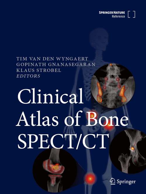 Book cover of Clinical Atlas of Bone SPECT/CT (2023)
