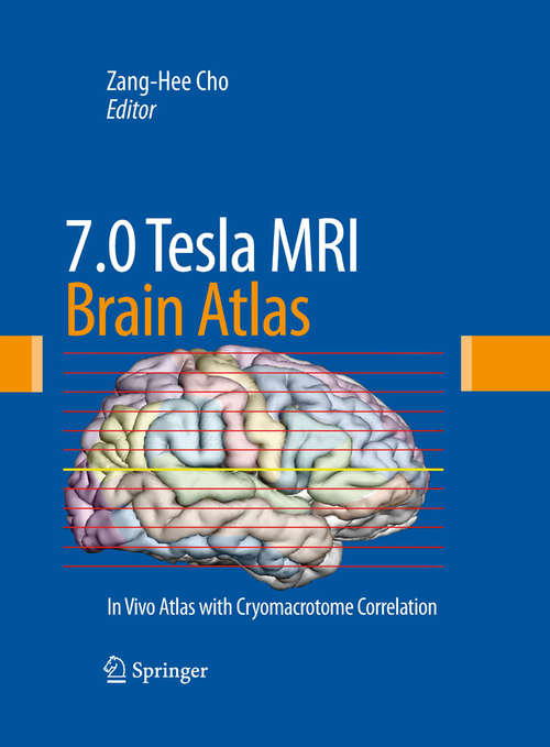 Book cover of 7.0 Tesla MRI Brain Atlas