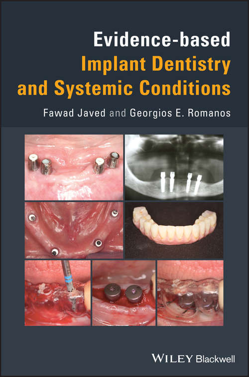 Book cover of Evidence-based Implant Dentistry and Systemic Conditions